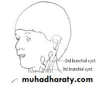 pediatric-surgery-3-neck-mass