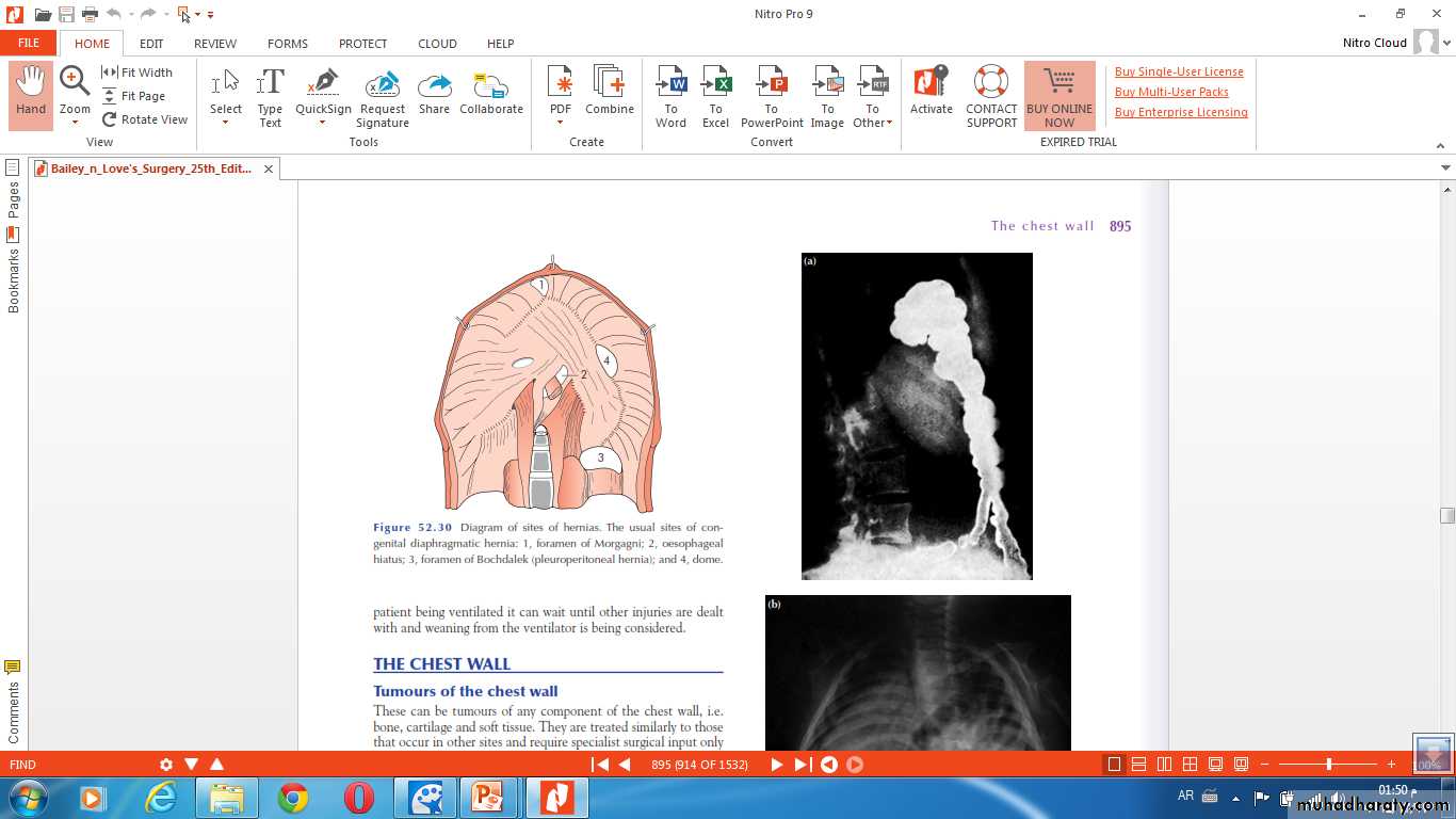 Paeditric surgical problems 3