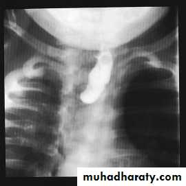 Paeditric surgical problems 3