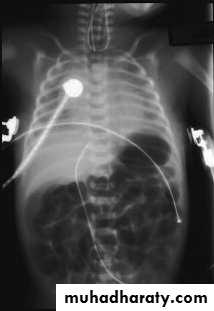 Paeditric surgical problems 3