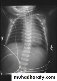 Paeditric surgical problems 3