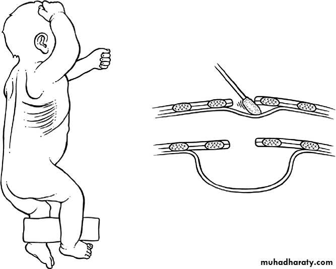 Paeditric surgical problems 3