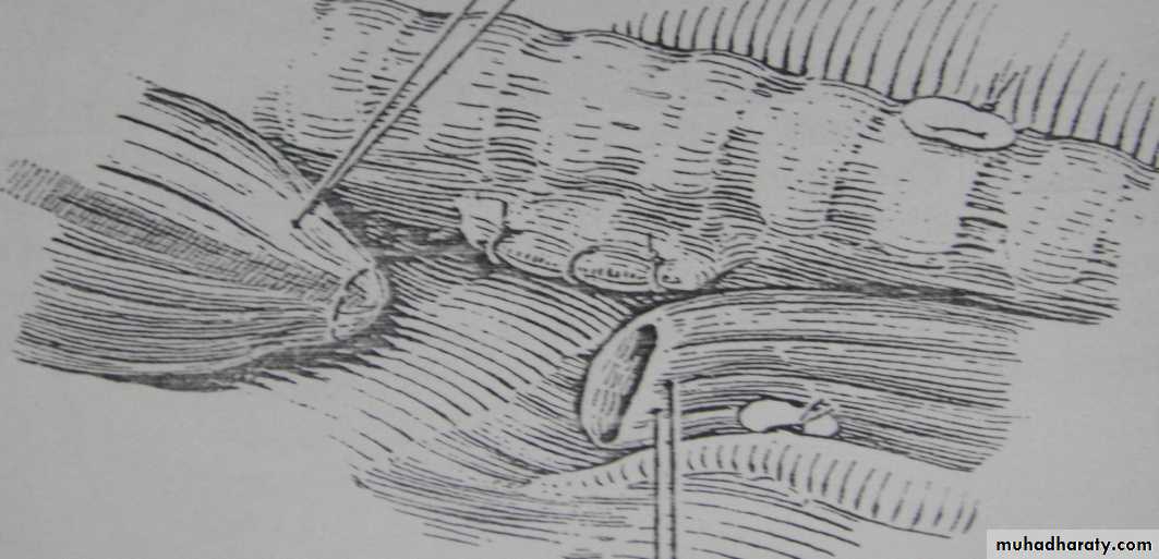 Paeditric surgical problems 3