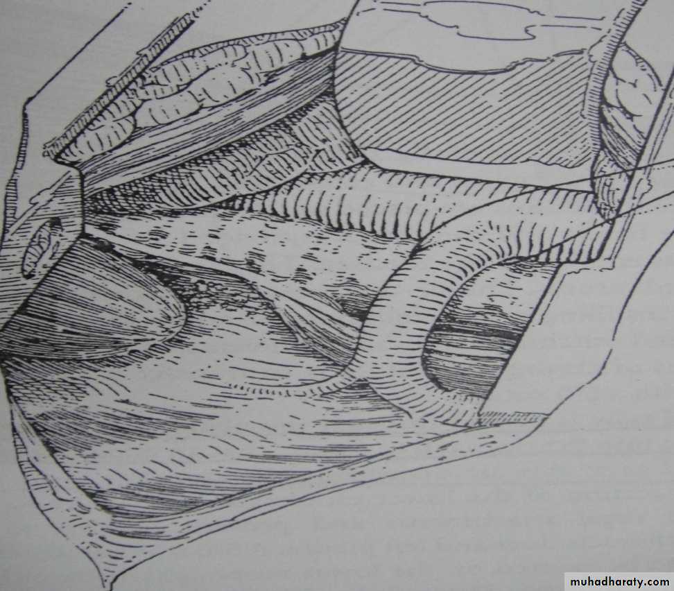 Paeditric surgical problems 3