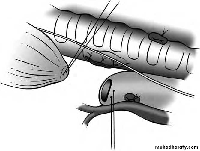 Paeditric surgical problems 3