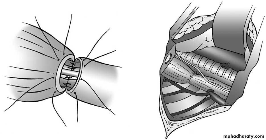 Paeditric surgical problems 3