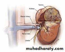 Paeditric surgical problems 3