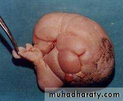 Paeditric surgical problems 3