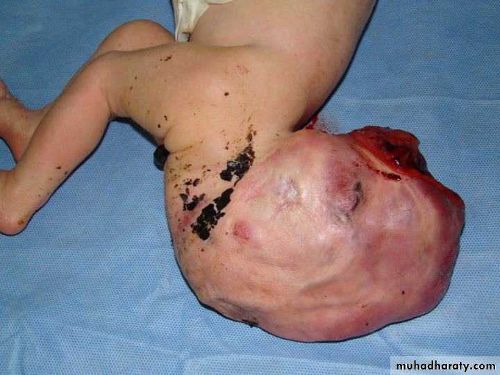 Paeditric surgical problems 3