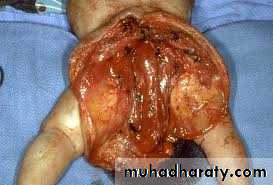 Paeditric surgical problems 3