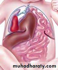 Paeditric surgical problems 3