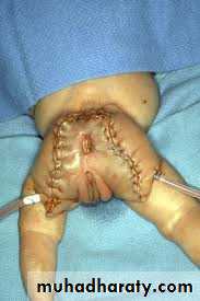 Paeditric surgical problems 3
