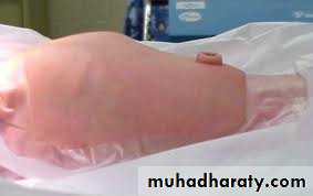 Paeditric surgical problems 3