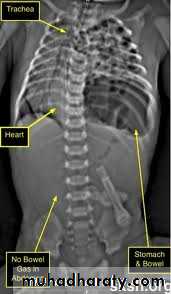 Paeditric surgical problems 3