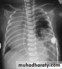 Paeditric surgical problems 3