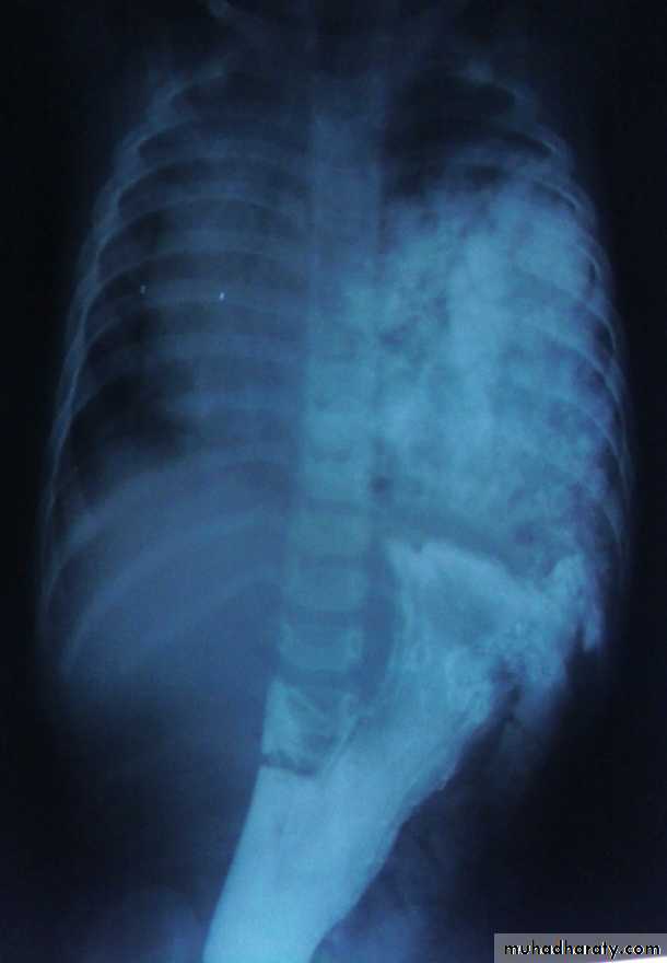 Paeditric surgical problems 3