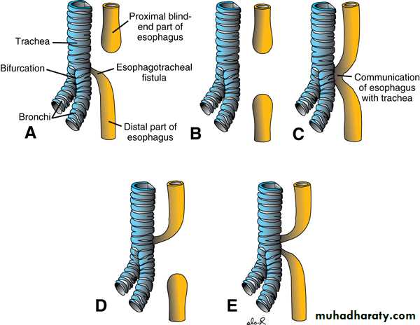 Paeditric surgical problems 3
