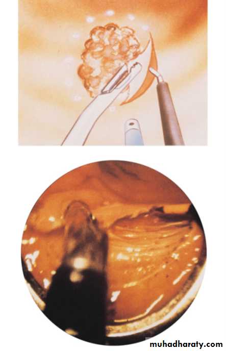 The rectum