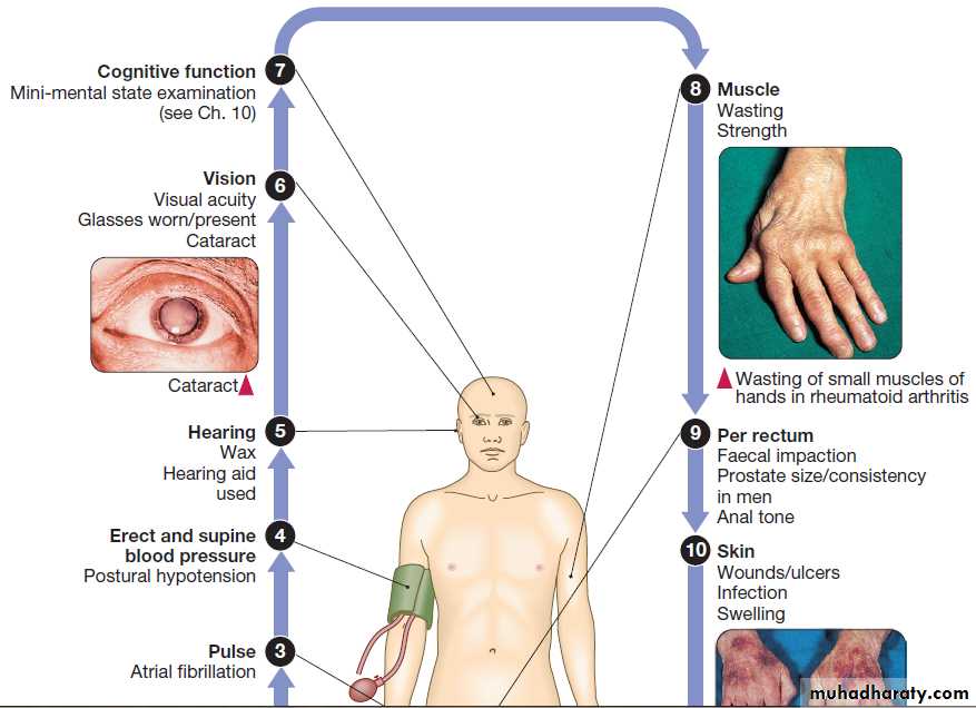 Ageing and disease