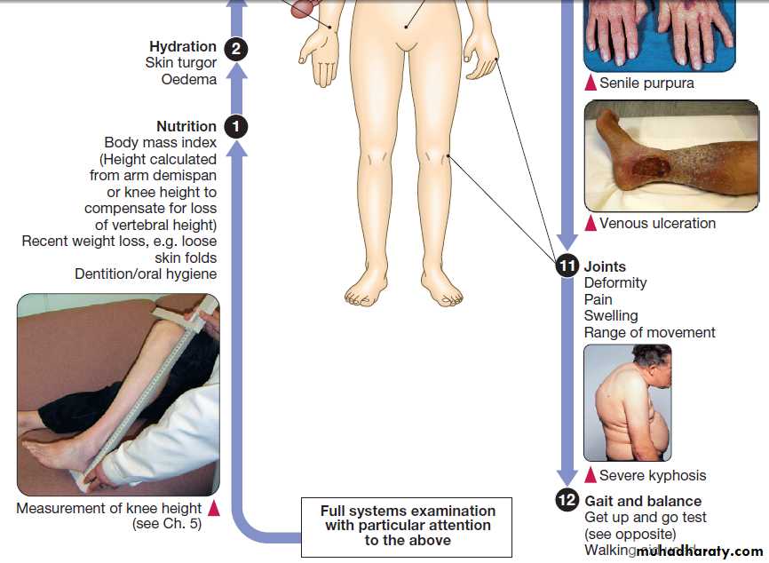 Ageing and disease