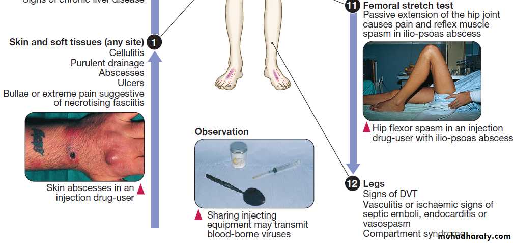 Infectious disease