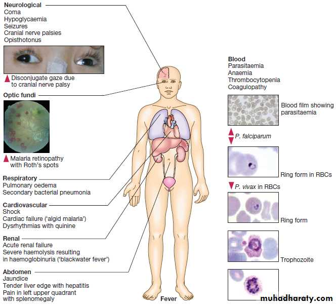 Infectious disease