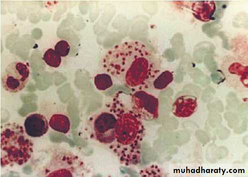 Infectious disease