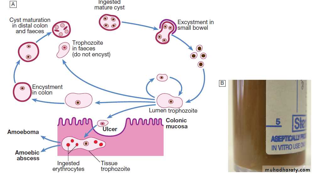 Infectious disease