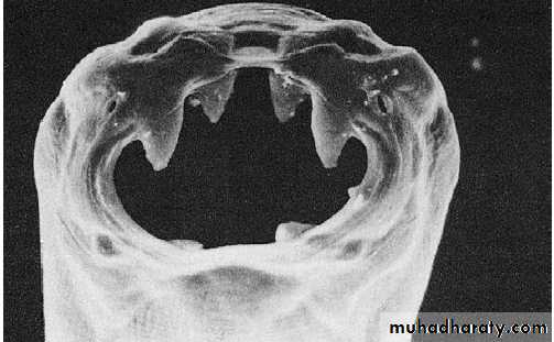 Infectious disease