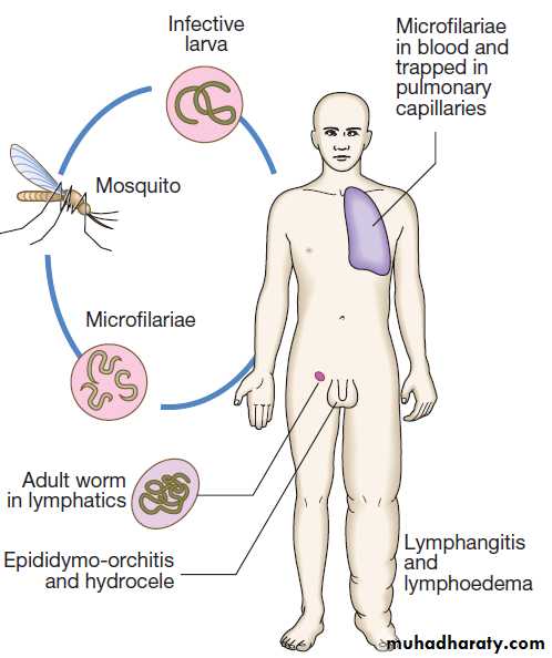 Infectious disease