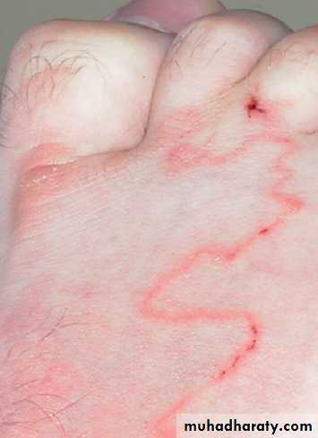 Infectious disease