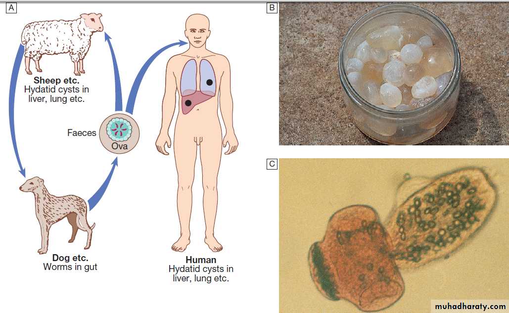 Infectious disease