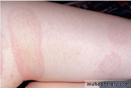 Infectious disease