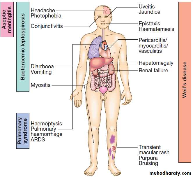 Infectious disease