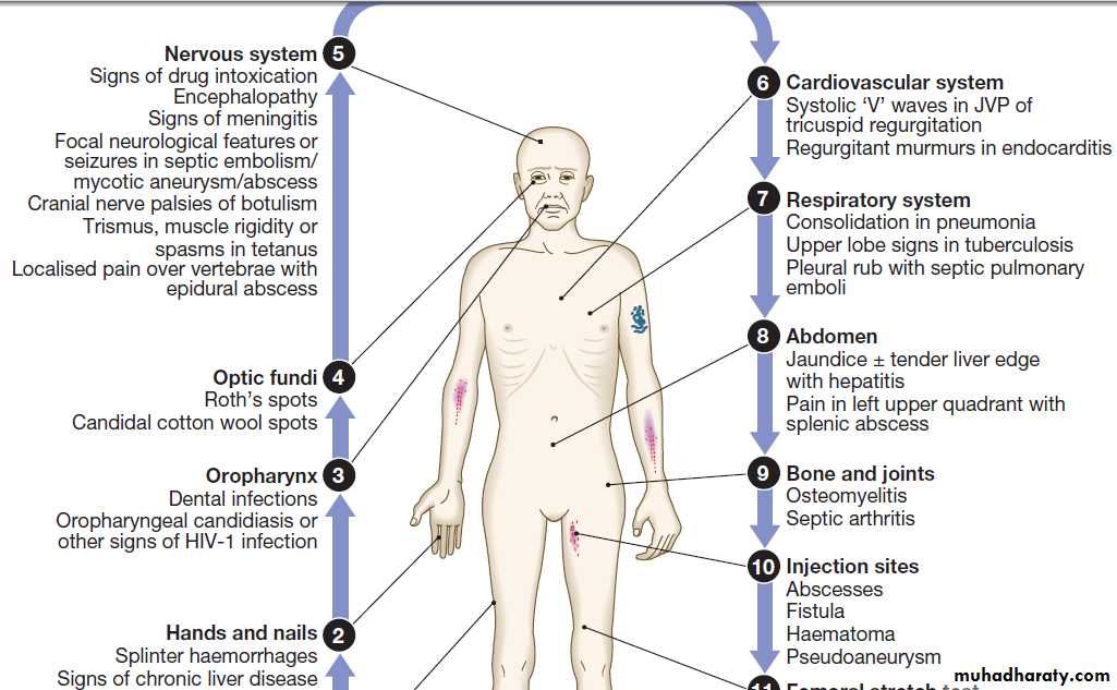 Infectious disease