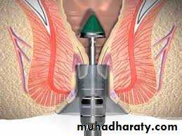 The rectum