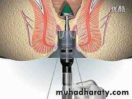 The rectum
