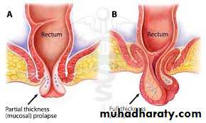 The rectum