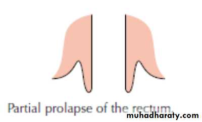 The rectum