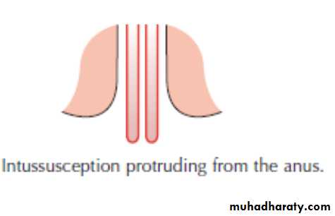 The rectum