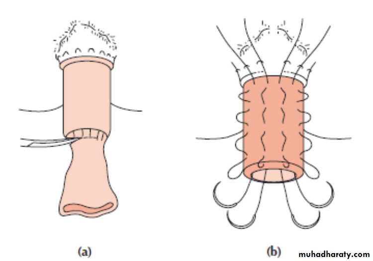 The rectum