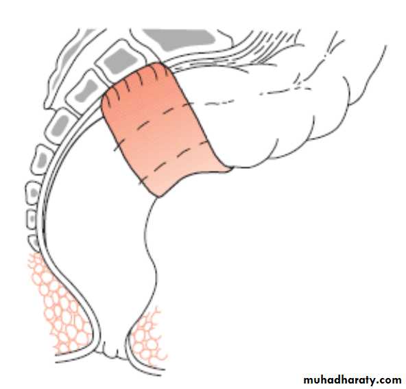 The rectum