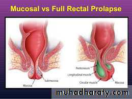 The rectum