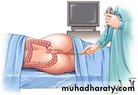The rectum
