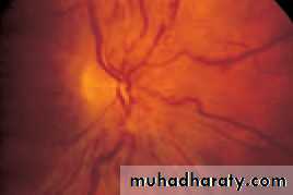 neuro ophthalmology