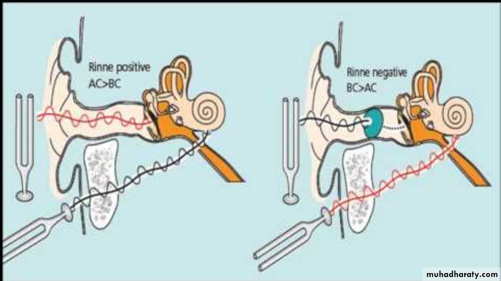 Visual and hearing