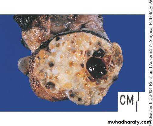 Male Reproductive System