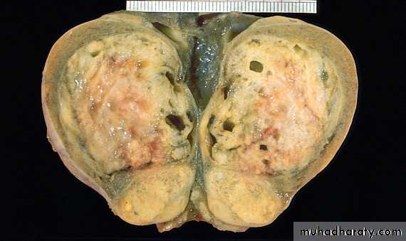 Male Reproductive System