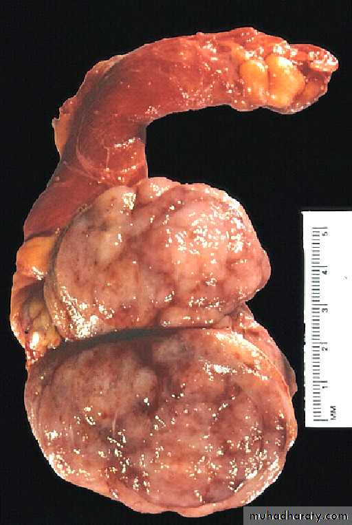 Male Reproductive System