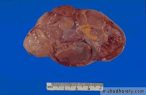 Male Reproductive System